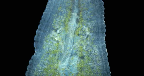 Leech family Glossiphoniidae under a microscope. Stock Footage 159399014