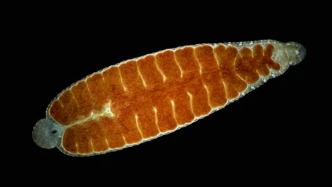 Leech of the family Glossiphoniidae under a microscope Stock Footage 159406056