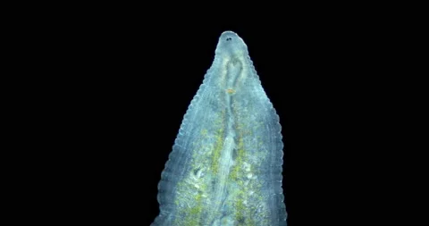 Leech family Glossiphoniidae under a microscope. Possibly  Helobdella stagnalis Stock Footage 236609921