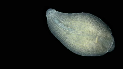 Leech family Glossiphoniidae under a microscope, Alboglossiphonia sp. Stock Footage 237755166