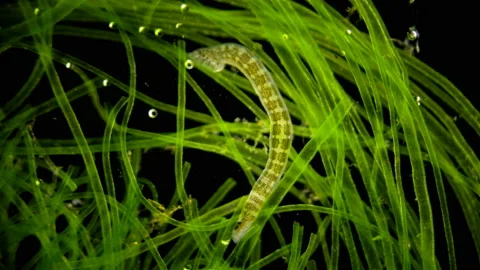 Leech. Fish leech Piscicola under the microscope Stock Footage 111284890
