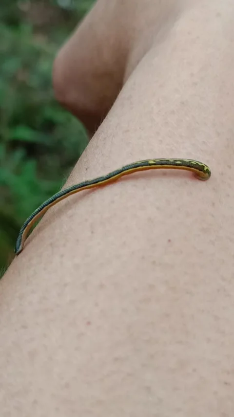 Leech on the hand Stock Footage 245958243