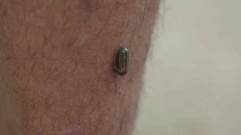 A leech has latched onto a person. Stock-Footage 334489354