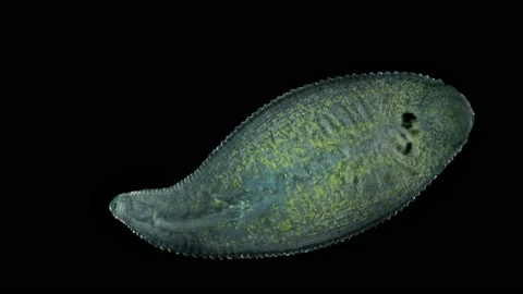 Leech Helobdella stagnalis under a microscope, family Glossiphoniidae Stock Footage 155685299