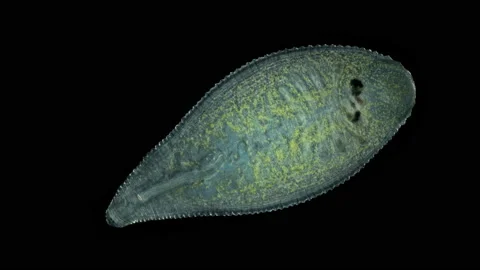 Leech Helobdella stagnalis under a microscope, family Glossiphoniidae Stock Footage 156440517
