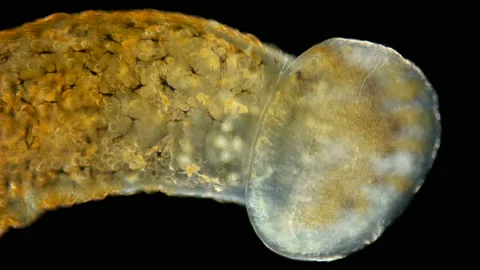 Leech Hirudinea, Baicalobdella torquata under a microscope, family Piscicolidae Stock Footage 141642886
