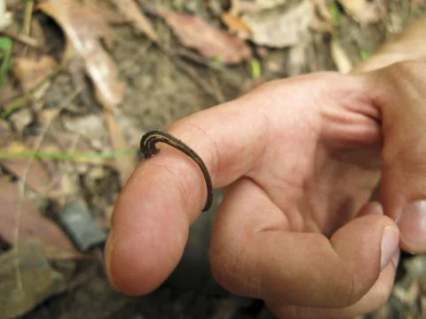 Leech on human skin Foto stock