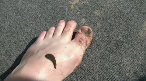 Leech on Skin Video stock 12592778