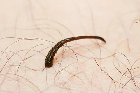 Leech on skin Stock Photos