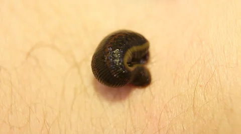 Leech therapy 01 Stock Footage 47001196