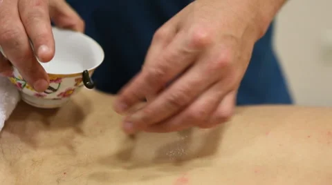 Leech therapy 05 Stock Footage 47000866