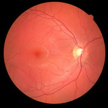Left eye's retinal image with macula, vessels and optic disc isolated view on Stock Photos