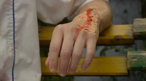 The left hand of the man with a burn on it, close-up, Halloween Stock Footage 68209251