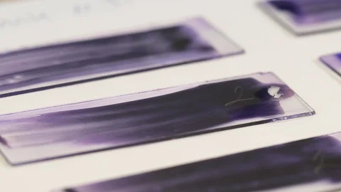 Left to right shot of microscope slides with samples. Using reagent for testing Stock Footage 108455685
