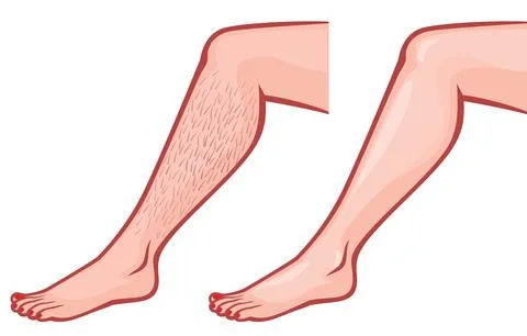 Leg after and before epilation Stock Illustration