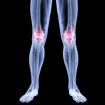 Leg Stock-Illustration