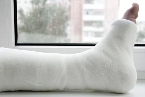 Leg in plaster Stock Photos