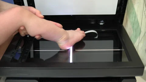 Leg scan process. The scanner in operation scans a child's foot with the lid Stock Footage 146319872