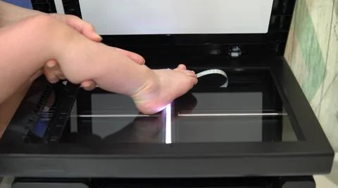 Leg scan process. The scanner in operation scans a child's foot with the lid Stock Photos