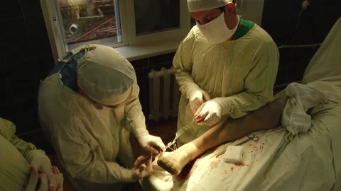 Leg surgery Stock Footage 130793868