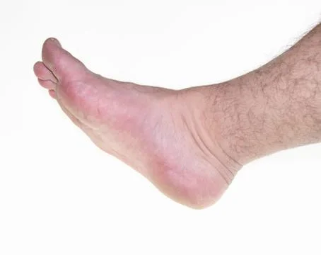 Leg on white background Stock Photos