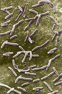 Legionella A view at the SEM: Scanning Electron Microscope. Copyright: xST... Stock Photos