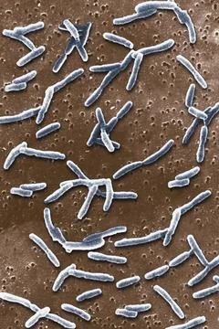 Legionella A view at the SEM: Scanning Electron Microscope. Copyright: xST... Stock Photos