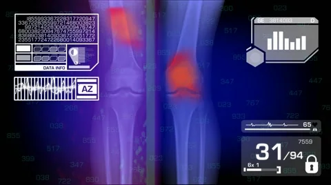 Legs Analysis - Graphics - White 01 Stock Footage 56842587