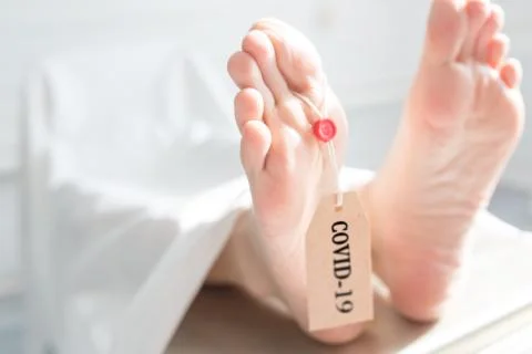 Legs of a corpse in a morgue on a table with a tag with the inscription COVID Foto stock