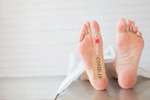 Legs of a corpse in a morgue on a table with a tag with the inscription COVID Foto stock