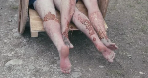 Legs full of worms of corpses transported with a wooden cart 95 Stock Footage 152794060