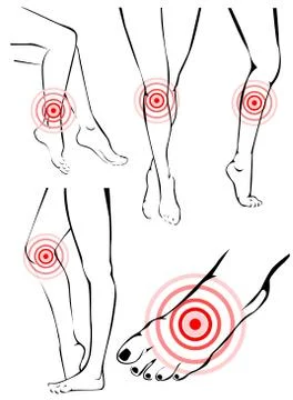 Legs pain Stock Illustration