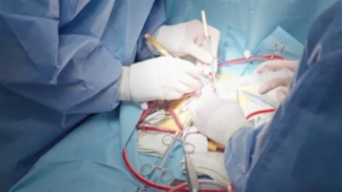 Lens blurred view, heart complex surgery process, close up of surgeons hands Stock Footage 311513595