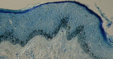 Leprosy of the skin tissue Stock Footage 145712966
