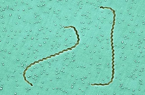  Leptospira interrogans meb Scanning electron micrograph of Leptospira int... Stock Photos