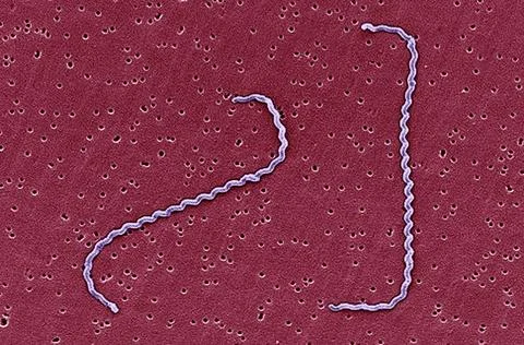 LEPTOSPIRA INTERROGANS, SEM Scanning electron micrograph of Leptospira int... Stock Photos