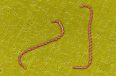 LEPTOSPIRA INTERROGANS, SEM Scanning electron micrograph of Leptospira int... Stock Photos