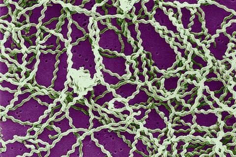  Leptospira meb Scanning electron micrograph of Leptospira bacteria on 0.1... Stock Photos