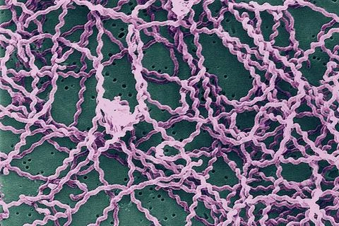  Leptospira meb Scanning electron micrograph of Leptospira bacteria on 0.1... Stock Photos