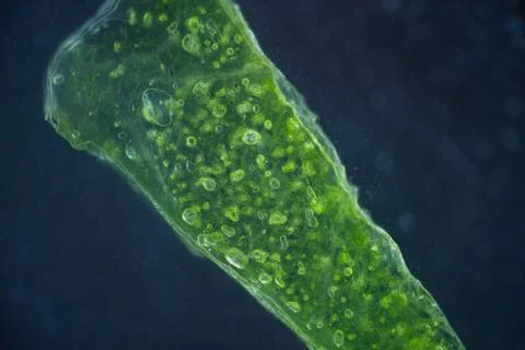 Lettuce cells under microscope, magnification x 100 dark field technique Stock Photos