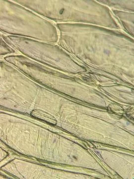 Lettuce Leaf Cells Viewed Under Microscop Foto stock