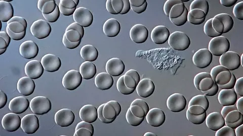 Leukocyte in human blood under microscopy view, 1000x magnification 库存影片 306575232