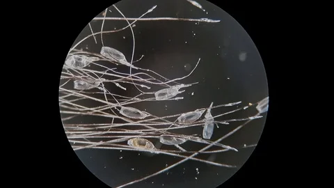 Lice egg on hair Video stock 120873065