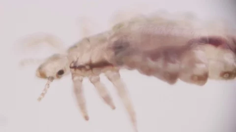 Lice 動画素材 76814083