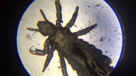 Lice microscope view Stock Footage 67273028