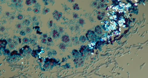 Lichens tissue Stock Footage 146120676