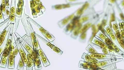 Licmophora sp. algae under microscopic view Stock Footage 282477279