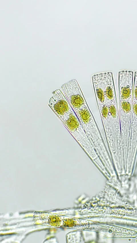 Licmophora sp. algae under microscopic view Stock Footage 282477447