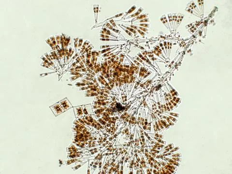 Licmophora sp. algae under microscopic view Stock Photos