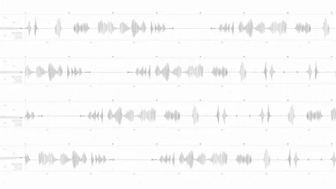 Lie Detector With Alpha Channel Stock Footage 83968451